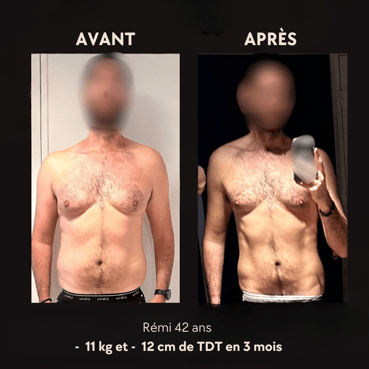 Copie de Rémi 42 ans - 11 kg et 12 cm de TDT